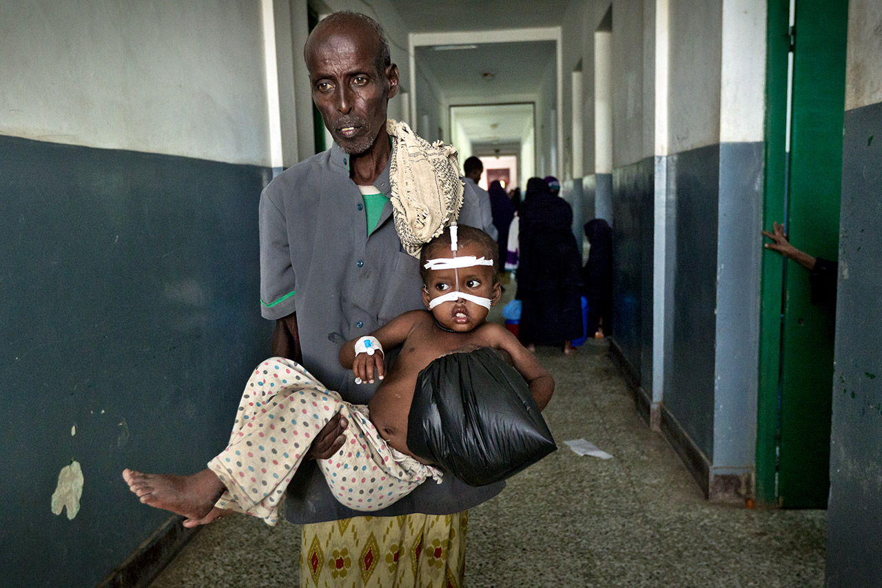 Somalia: Ein Vater trägt sein an Diarrhöe erkranktes Kind auf dem Gang der Kinderstation eines Hospitals. Photo: Christoph Püschner/Diakonie Katastrophenhilfe